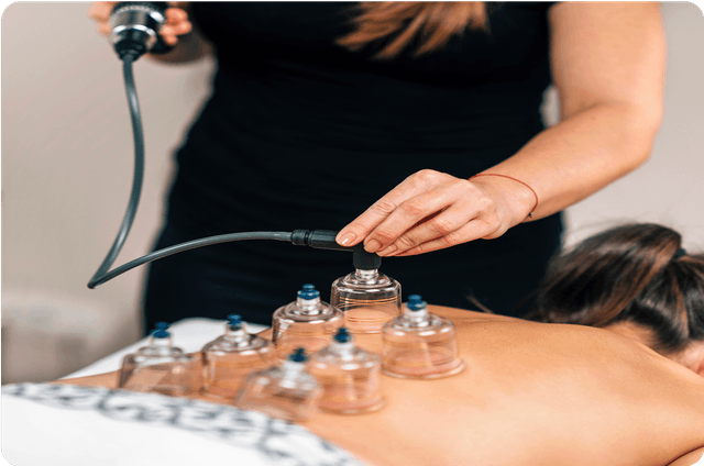 Hijama Therapy Image